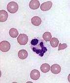 Anaplasmosis Infects certain white blood cells Not known how cause disease 10 days post-infection strong