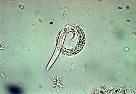 [26] Dictyocaulus fillaria lung worm of sheep and goats Muellerius capillaries lung worm of sheep and goats Figure 2: Species of