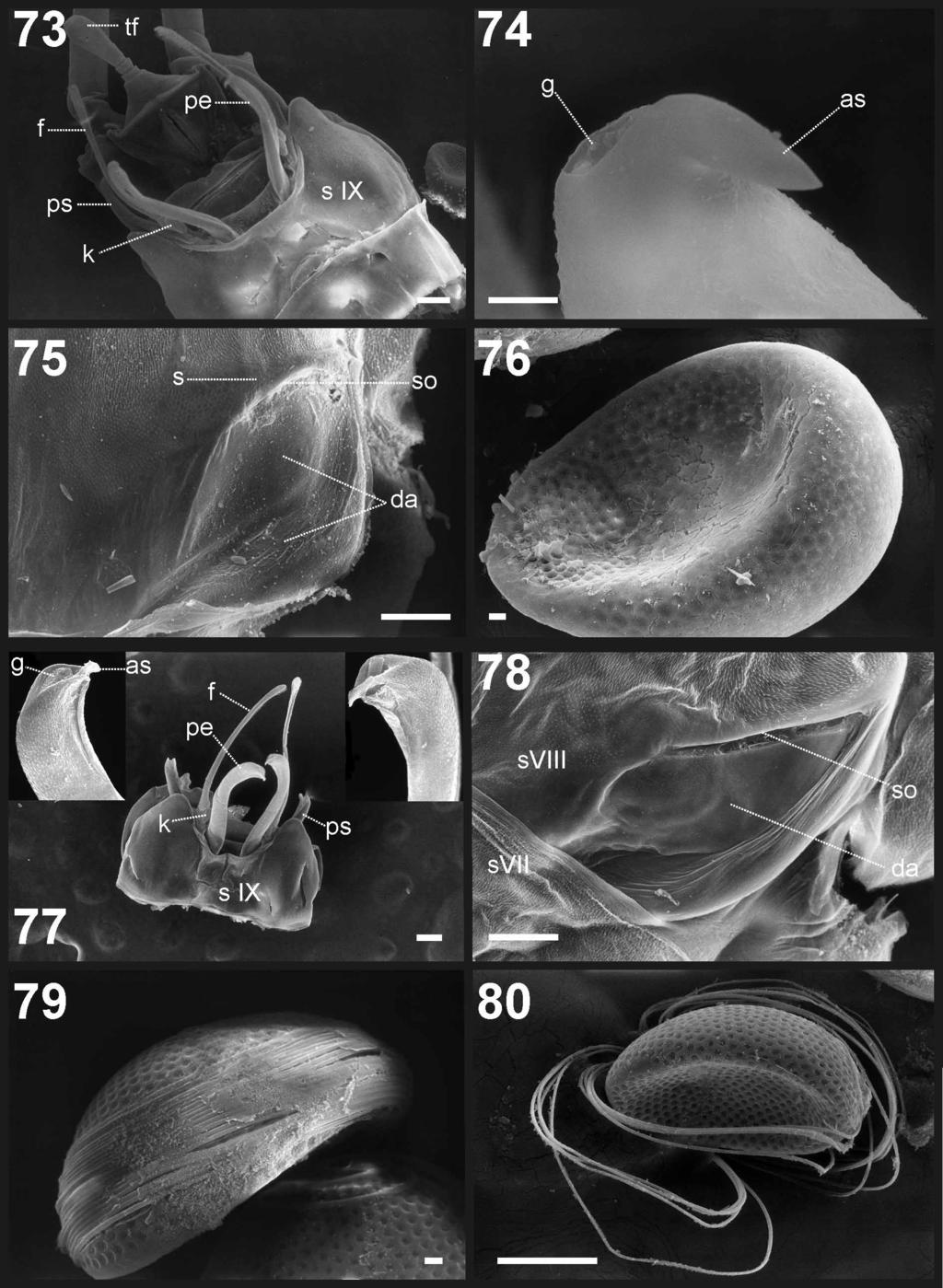 FIGURES 73 80. SEM photographs. Tortopsis limoncocha: 73, male genitalia, v.v.; 74, apex of penes, detail; 75, female abdominal sternum VIII, detail of left socket; 76, egg.