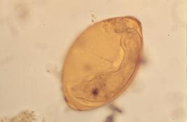 of Fasciola hepatica Adult fluke