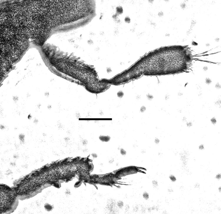 Fig. 5. Antenna (above) and fore tibiotarsus (below) of Stenommatus tanyrhinus n. sp. in Dominican amber. Note the four segmented funicle and subtruncate club with a tomentose apical surface.
