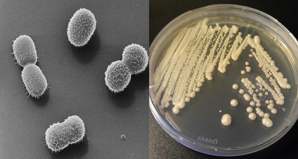 A. baumannii has been identified as an ESKAPE pathogen, a group of pathogens with a high rate of antibiotic resistance that is responsible for the majority of nosocomial infections [95-97].