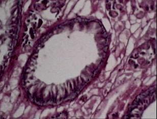 Oxyclozanide treated fluke showing massive shrinkage of smooth muscle and disintegration of testis Fig 10.