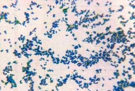 short rod-shaped organism Fig.3. Staphylococcus sp.