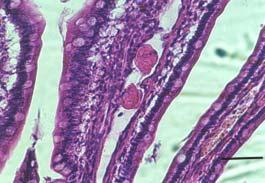 Fig. 3. Eosinophilic material in the lacteal of the intestinal villi. H&E; 100; scale bar = 50 µm. macroscopically visible.