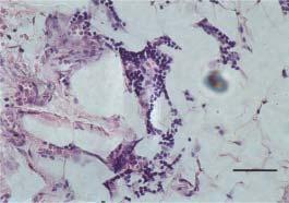 Fig. 6. Mesenterial lymphatic vessel was completely obturated by mononuclear cells and forming granuloma. H&E; 50; scale bar = 100 µm.