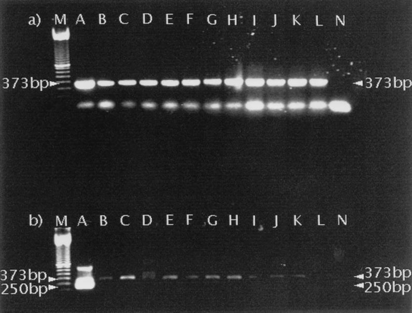 VOL. 36, 1998 COPRODIAGNOSIS OF ECHINOCOCCUS MULTILOCULARIS 1873 FIG. 3. PCR amplification with P60.for.-P375.rev. (a) followed by amplification with Pnest.for.-Pnest.rev. (b) of DNA from 12 different tapeworm species.