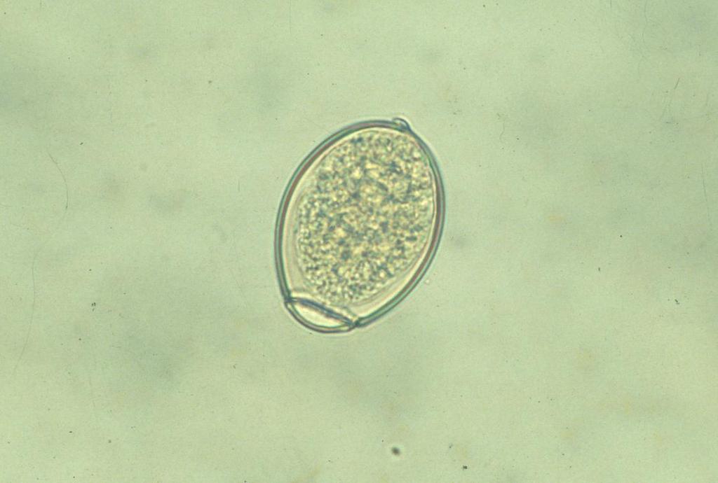 Diphyllobothrium latum Unstained egg from the fish tapeworm in stool.