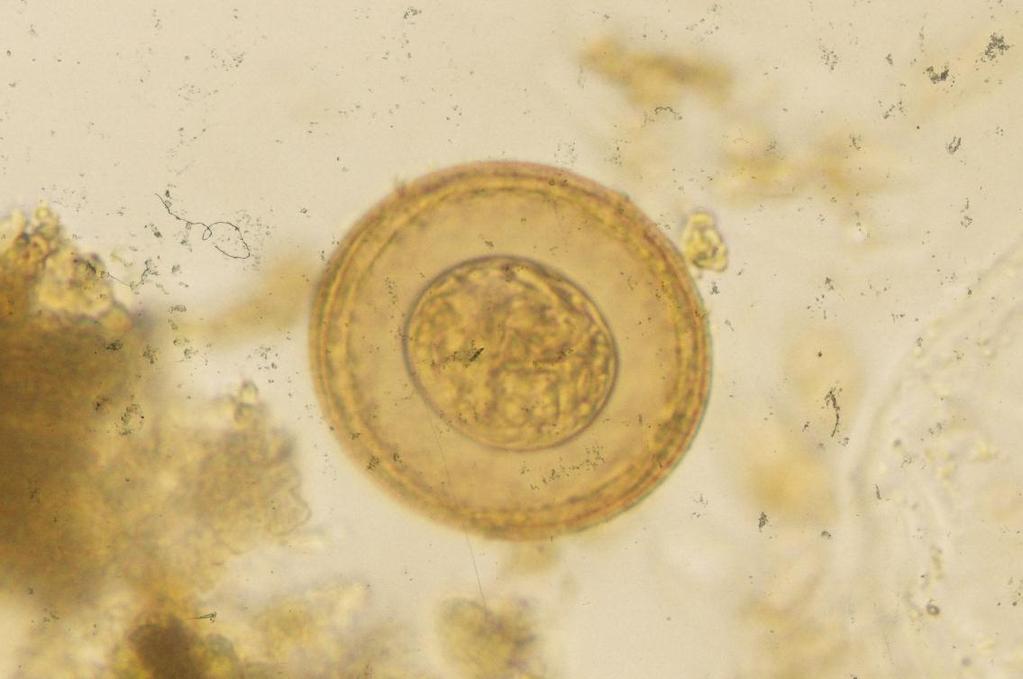 Hymenolepis diminuta Oval and yellow-coloured egg in faeces.