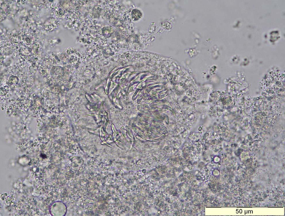 Echinococcus granulosus Brood capsule in