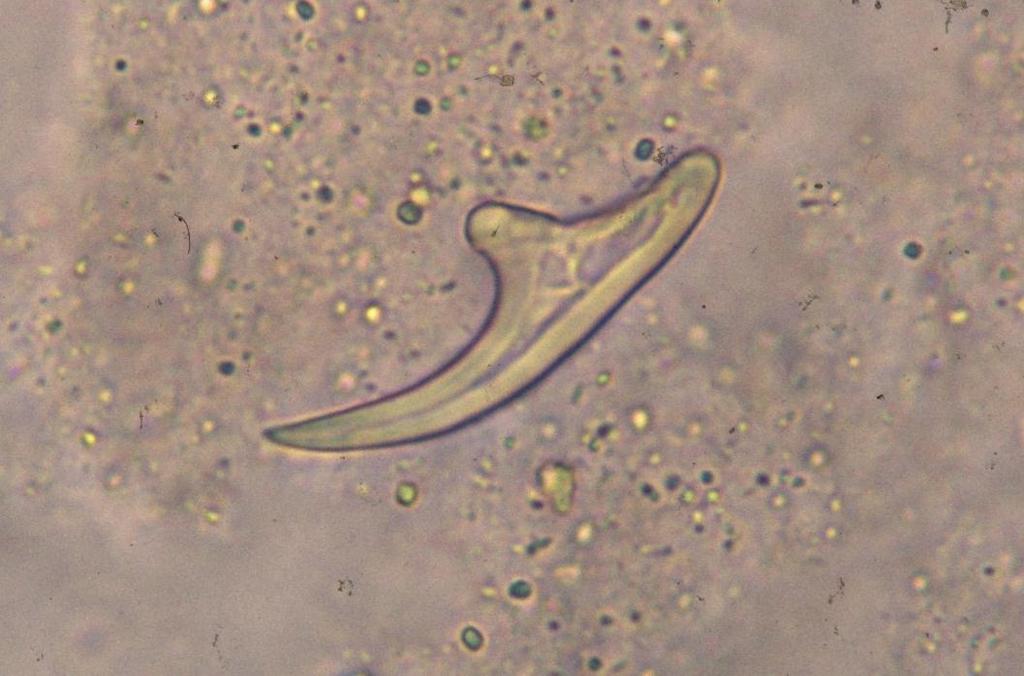 Echinococcus granulosus Free hooklet in