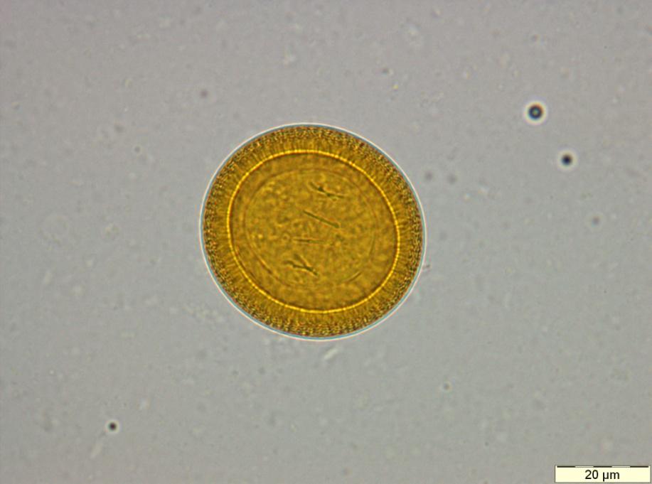 Taenia sp. Egg with four (visible) hooklets (stained with Lugol).