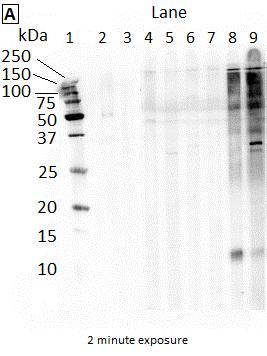 Figure 4.7. Western blot of larval B. procyonis ESA recognized by P. equorum naturally infected equine IgG(T) and P. equorum or B. procyonis immunized rabbit IgG.