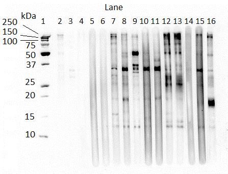 Figure 4.8. Western blot of larval B. procyonis ESA recognized by P.equorum naturally infected equine IgG(T), B. procyonis or T. canis inoculated rabbit IgG, and T.