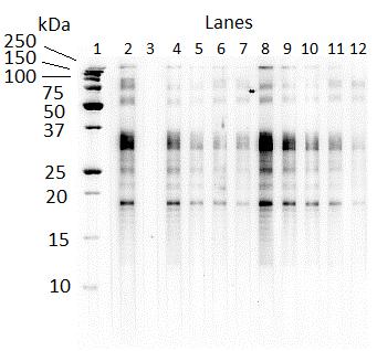 Figure 5.6. Western blot of latest Foal3 and Foal4 samples with IgG(T) recognition of larval P. equorum ESA.