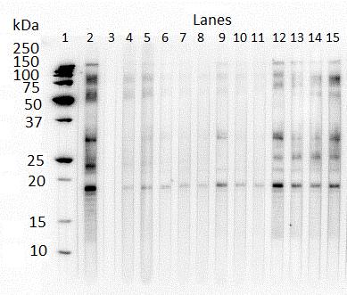 Figure 5.8. Western blot of last Foal13 samples with IgG(T) recognition of larval P. equorum ESA.