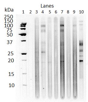 Figure 5.11. Western blot of monospecific or parasite-free control IgG(T) antibody recognition of larval P. equorum ESA.