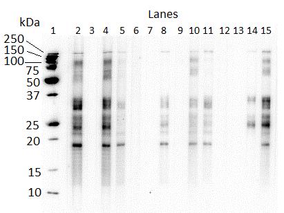 Figure 6.1. Western blot of older horse IgG(T) antibody recognition of P. equorum larval ESA. Lane 1, molecular weight standards; Lane 2, foal positive for P.