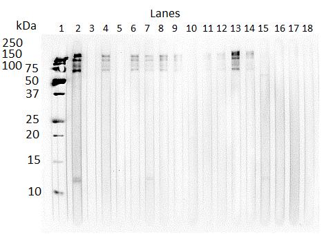 Figure 6.2. Western blot of IgG(T) antibody recognition of P. equorum immature adult ESA by foals with patent infections.