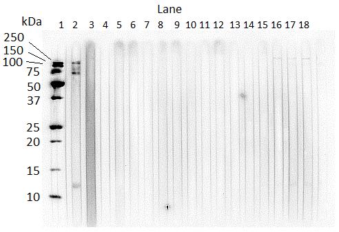 Figure 6.3. Western blot of Foal4 IgG(T) antibody recognition of P. equorum immature adult ESA over time. Lane 1, molecular weight standards; Lane 2, foal positive for P.