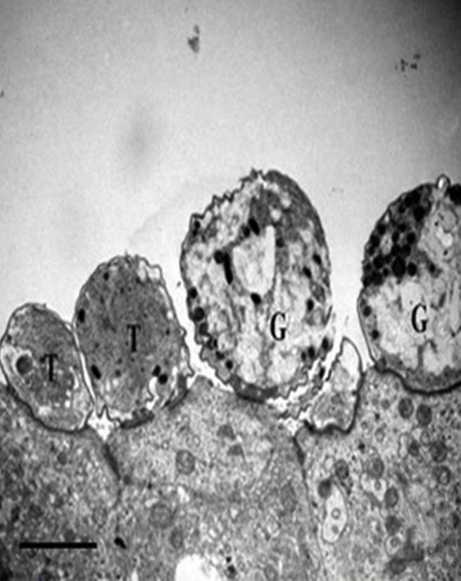 Nevertheless, it could be suggested that simultaneous infection with two or more intestinal protozoan parasites could aggravate the severity of the intestinal lesions and clinical manifestations.