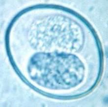 Coccidia characterized by thick-walled oocysts excreted in feces In