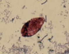 Cryptosporidium 4-5 mm oocysts 4 sporozoites