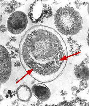 Intestinal and Luminal protozoa Microsporidia spp.