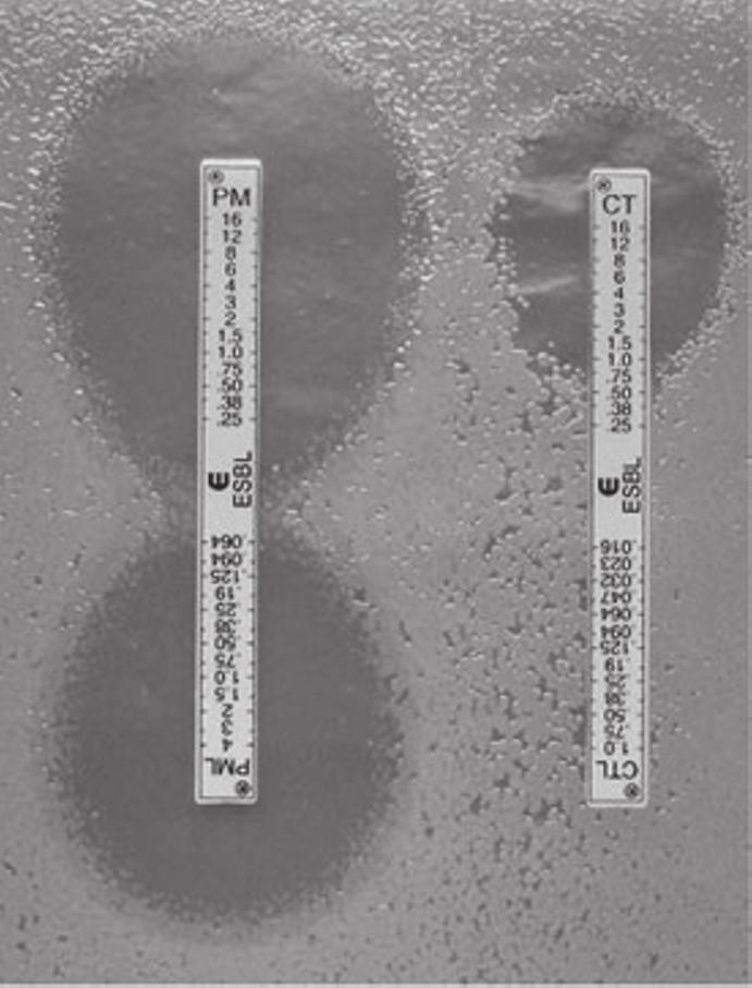 4d, where the ESBL Etests on Mueller Hinton agar indicated out-of-range MIC values, whereas those on cloxacillin-containing agar (Fig.