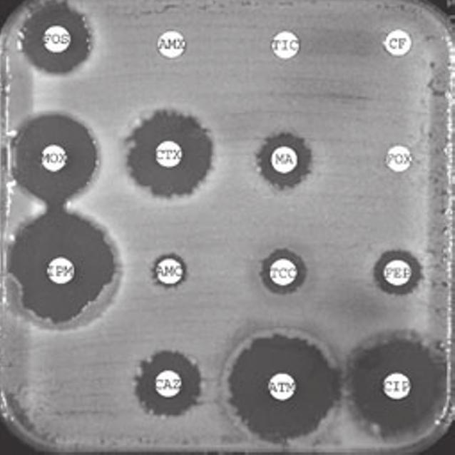 For the ESBL-non-producing strain, ESBL Etests were not interpretable for either PM PML or CT CTL (Fig. 6c). Both tests were negative on cloxacillincontaining agar (Fig. 6e).