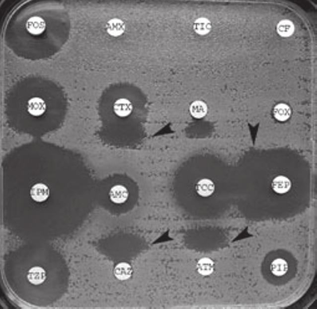 Extended-spectrum b-lactamase detection by a double-disk diffusion test on agar containing cloxacillin (200 mg L) for clinical isolates that stably overproduce a cephalosporinase.