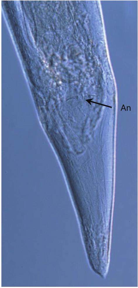 Two spicules simple, slender, and approximately similar in size, with short, spatulate tips. Gubernaculum present (Fig. 1D).