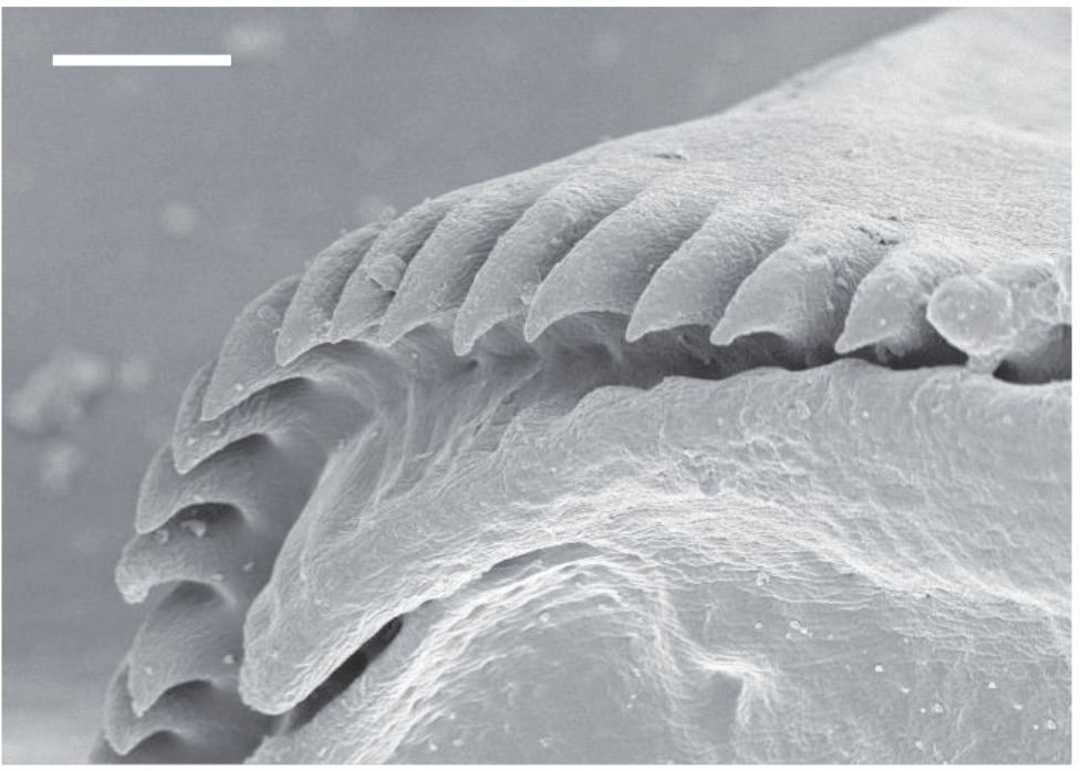excavata (Bar= 50 µm). (B) Ventrolateral view of the head (Bar=50 µm).