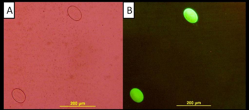 Fig. 10. Formalin FITC-labeled H. contortus ova without (A) and with (B) UV light.