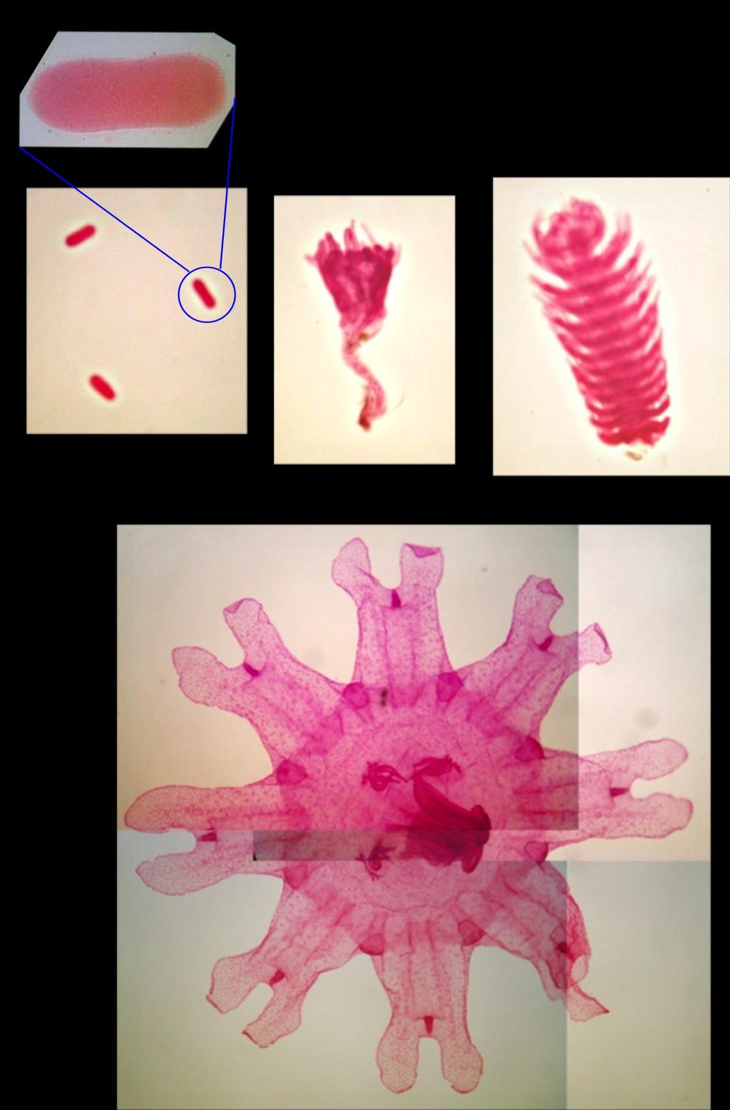 P S St PHYLUM Cnidaria CLASS Scyphozoa Life Cycle Stages 2 Medusae produce gametes Egg + sperm = zygote E