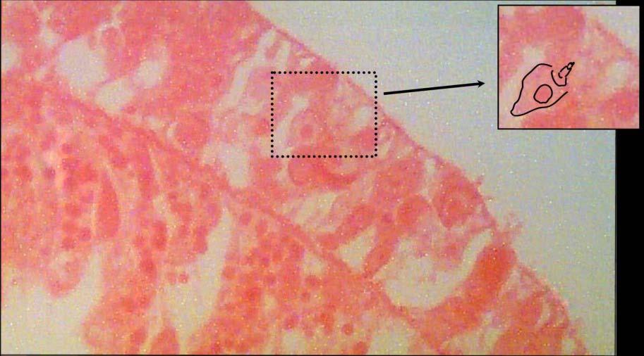 Insert: A Cnidocyte cell containing a Nematocyst - organelle