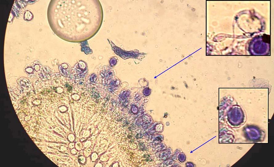 Phylum Cnidaria Cnidocil = trigger Undischarged barbs Thread with stylet Cnidae = nematocyst Cnidocyte with nucleus Specialized cells called cnidocytes contain capsule-lie organelles