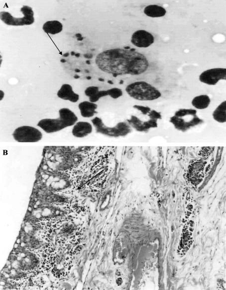 Uveitis associated to the infection by Leishmania chagasi in dog from the Olinda city, Pernambuco, Brazil.