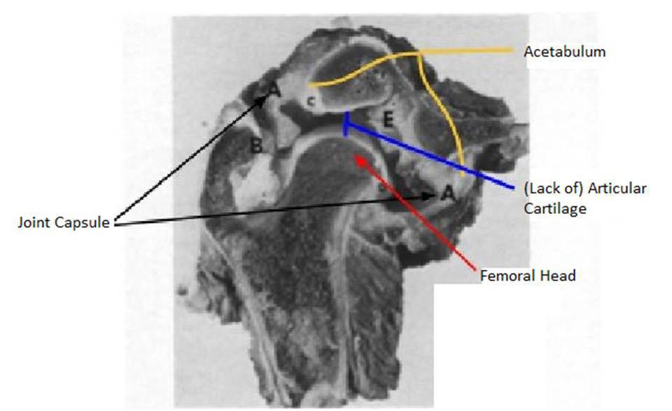 Figure 2: Anatomy of normal hip development.