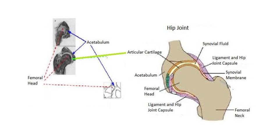 and pelvic socket already do not have normal alignment. (Adapted from Riser et al.