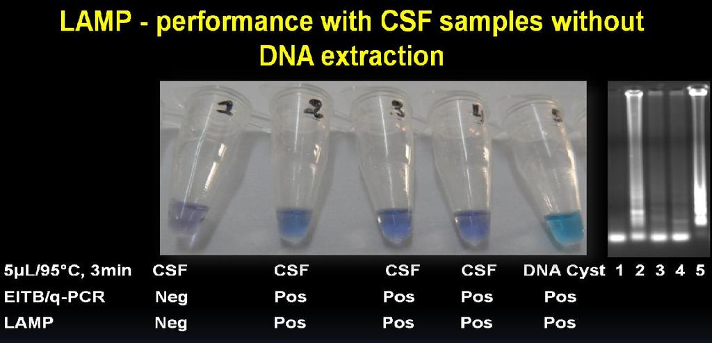 Diagnostic of NCC by LAMP: initial results (2) LCRs Assay Gene: Cox1 CSFs DNA