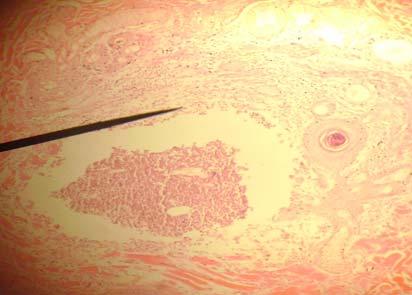 hair follicular cells in Demodex canis infestation (330x) Fig