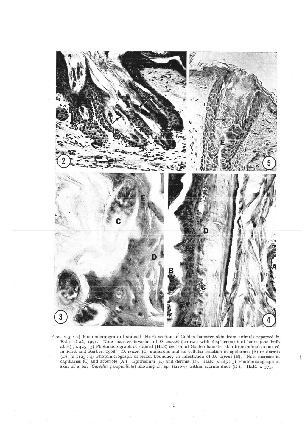 FrGs. 2-5 : 2) Photomicropgrah of stained (HaE) section of Golden hamster skin from animals reported in Estes et al., 1971. Note massive invasion of D.