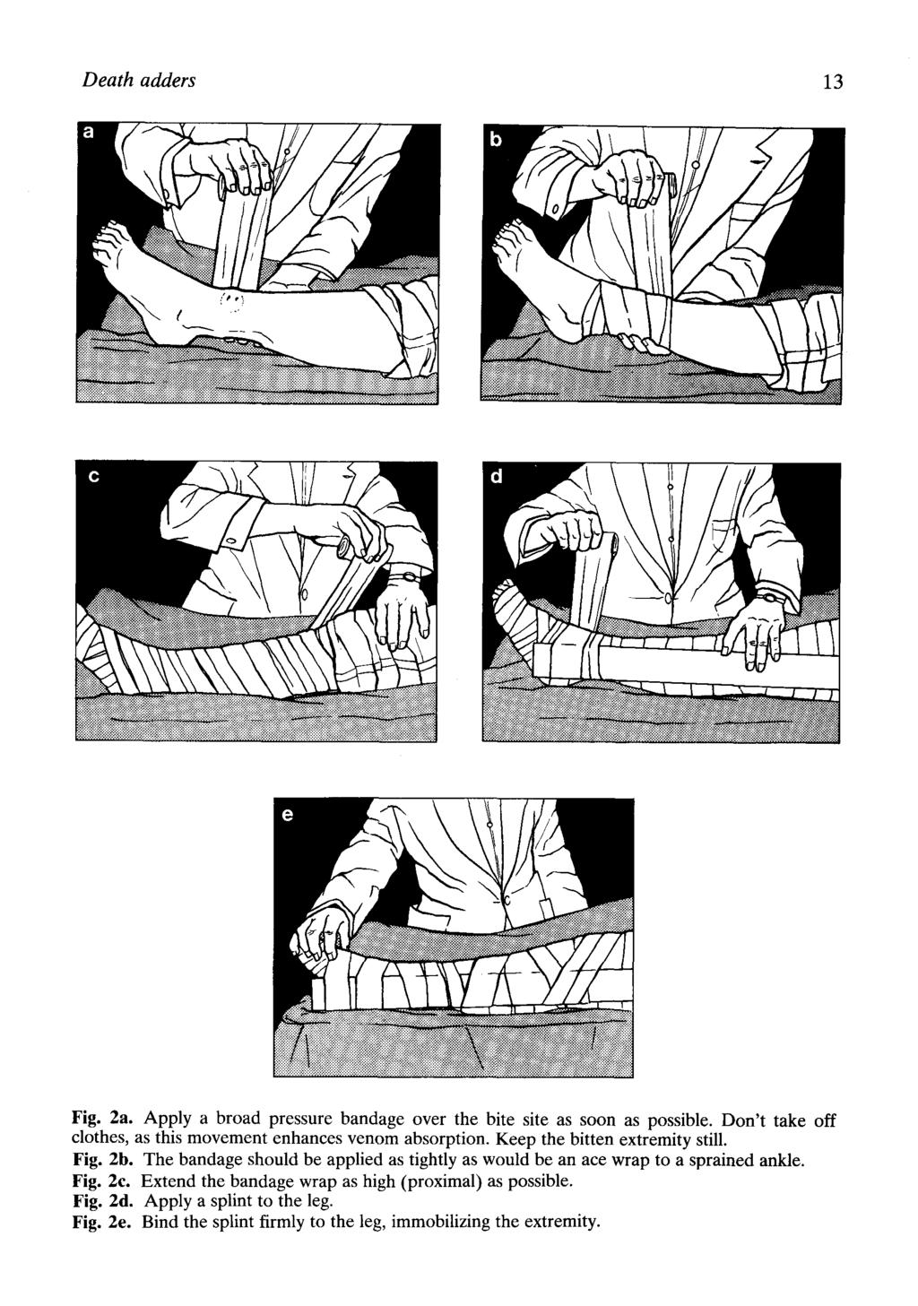 Death adders 13 Fig. 2a. Apply a broad pressure bandage over the bite site as soon as possible. Don't take off clothes, as this movement enhances venom absorption. Keep the bitten extremity still.