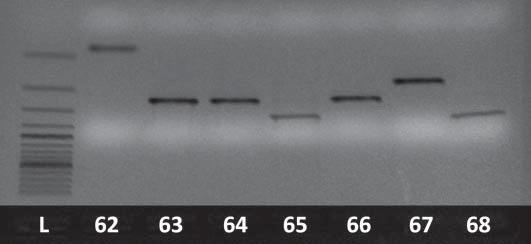 Agarose gel electrophoresis - determination of PVL-positive Staphylococcus aureus strains (samples from 58 to 61), L-100 bp ladder Fig. 2.