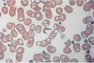 Topic-Chagas Disease (American Trypanosomiasis) Figure 1.