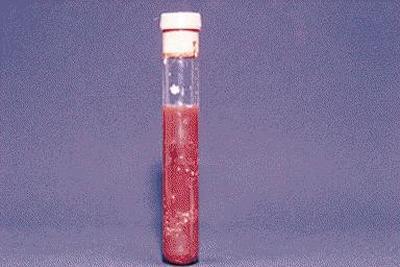 Topic-Anaerobic Infections Figure 1.