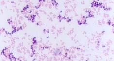 Cells on a microscope slide are heat-fixed and stained with crystal violet.