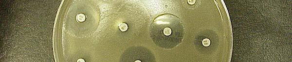 is visible and no zone of inhibition appears around the disk. Agar plate with lawn of bacterial growth.