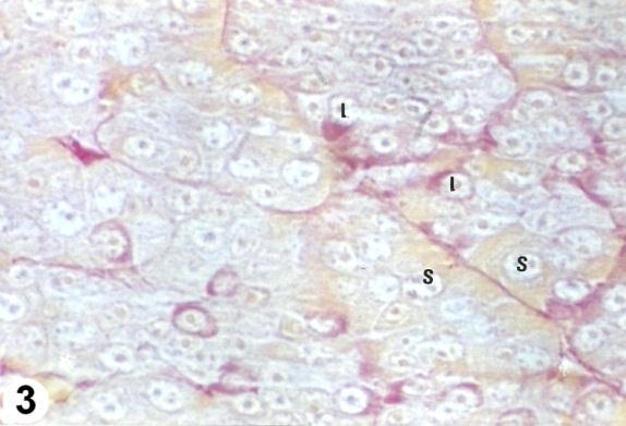 Fig (1): Section from pars distalis of one day old chick showing a mitotic